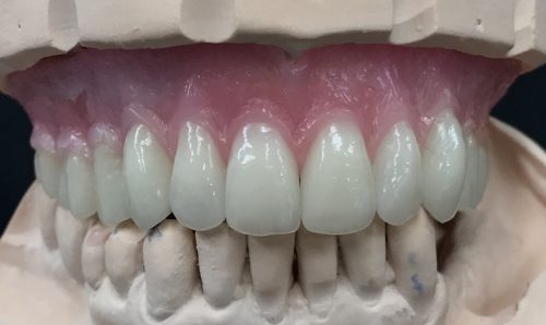 Teeth Front